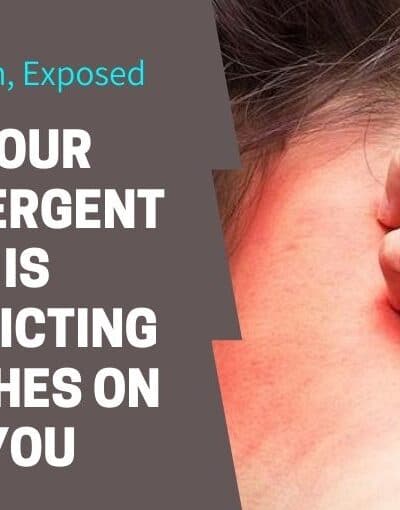 How To Prevent Laundry Detergent Rashes